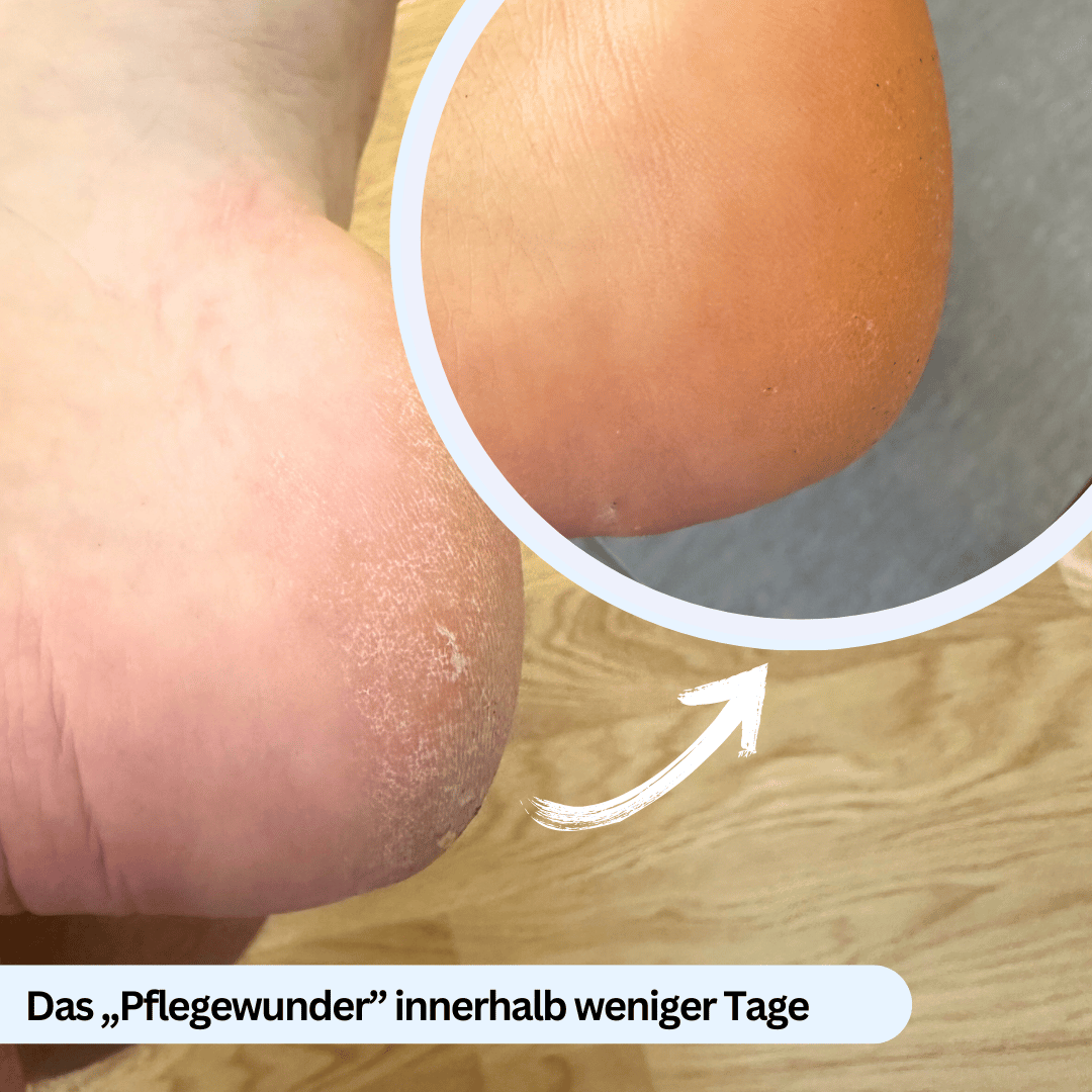 Nuwelo's Hydra Fersen-Socken