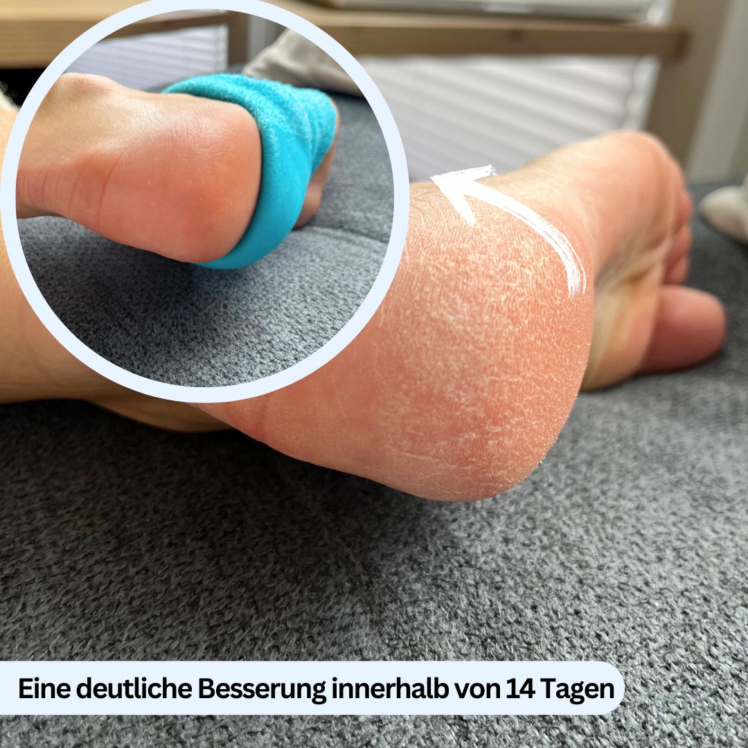 Mann verwendet Nuwelo Fersensocken zur Fußpflege im Alltag