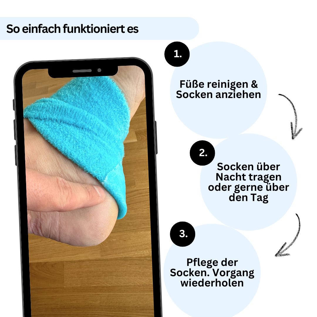 Anwendung der Nuwelo Fersensocken über Nacht – unkomplizierte Fußpflege