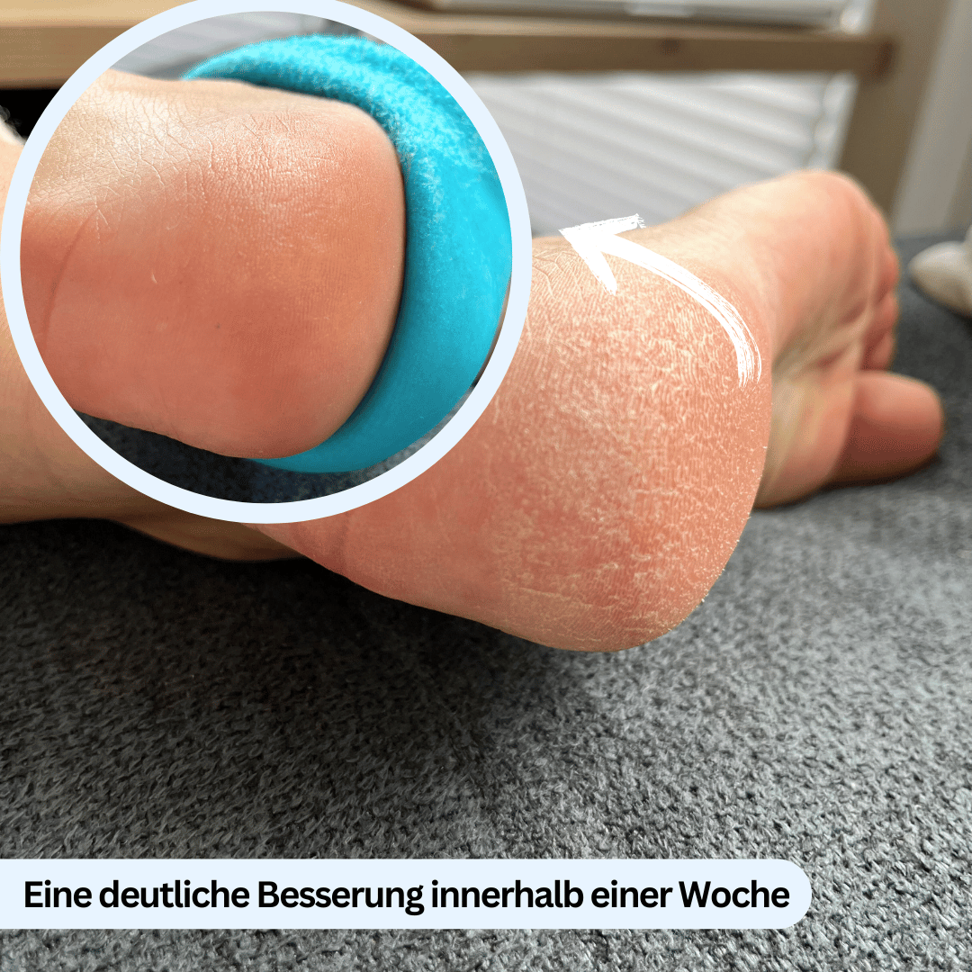 Nuwelo's Hydra Fersen-Socken