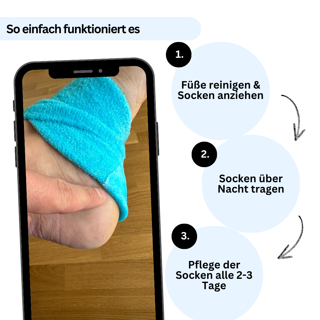 Schritt-für-Schritt Anleitung zur Anwendung der Hydra Fersen Socken über Nacht.