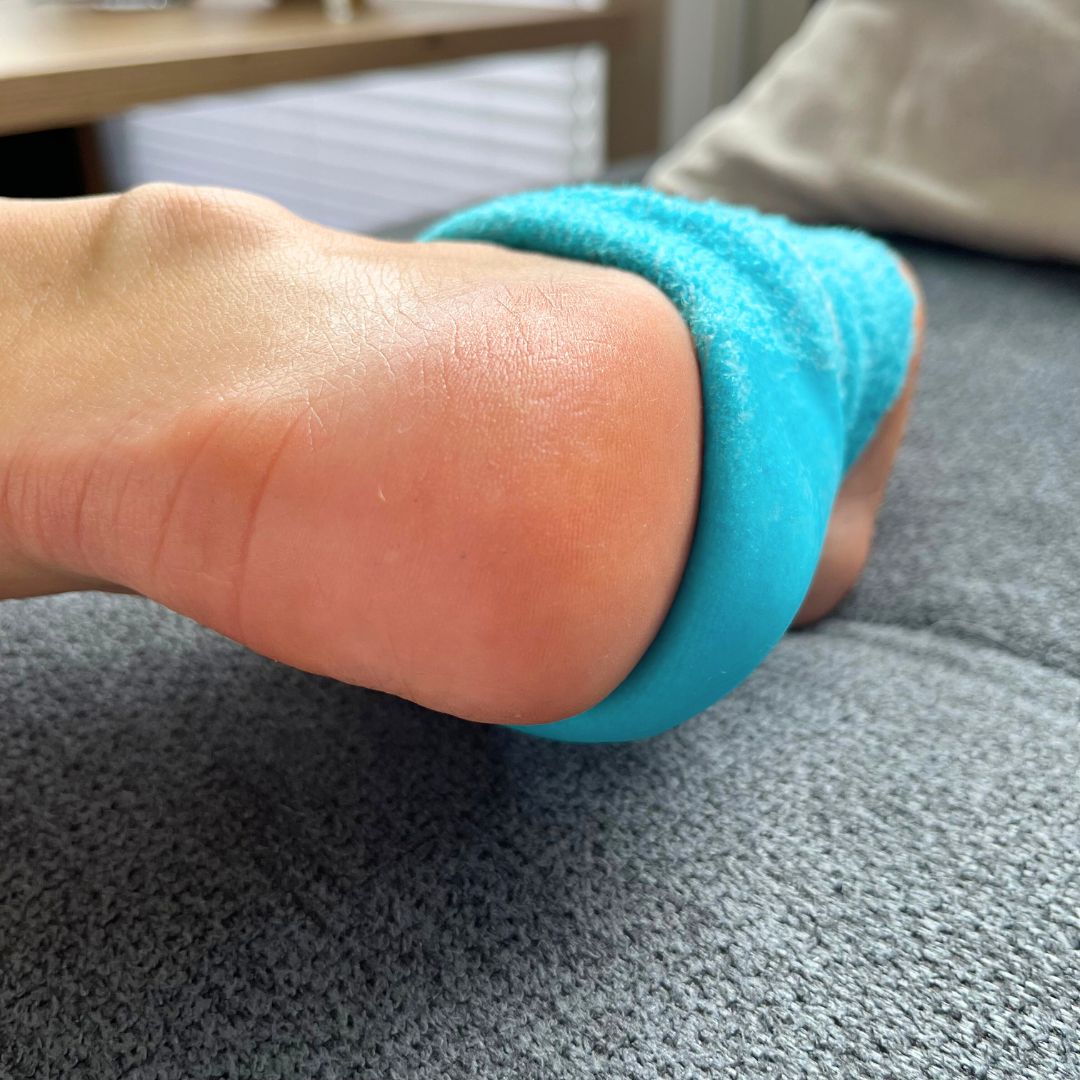rockene Ferse vor der Pflege mit Hydra Socken – rechts sichtbar weiche, regenerierte Haut.